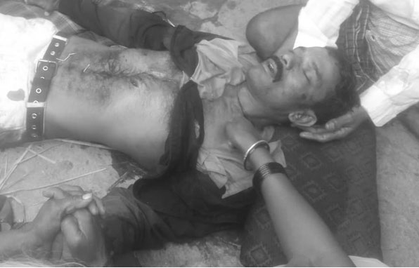 ಮಂಡ್ಯ | ಅಸ್ತಿಗಾಗಿ ಜಗಳ : ಅಣ್ಣನಿಂದಲೇ ತಮ್ಮನ ಕೊಲೆ